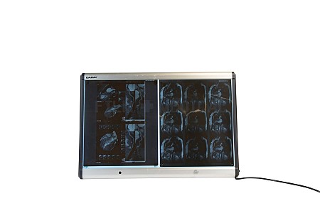 Double Wall Mount Light Box X- Rays priced Separately 